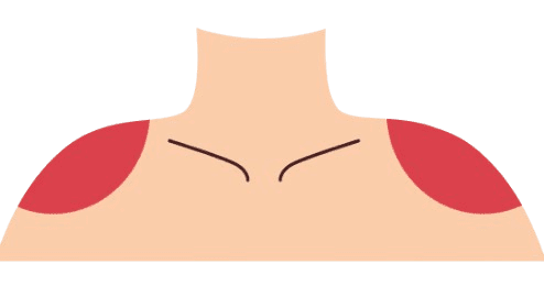 epaules